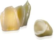 ジルコニアセラミッククラウン